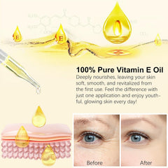 flasture Vitamin E Oil 75,000 IU – 100% Pure Natural Vitamin E for Skin, Face, Hair, Scars – Deep Moisturizing Body Oil for Dry Skin, Wrinkles – Cold-Pressed, Non-GMO,Skincare – 2 Fl Oz